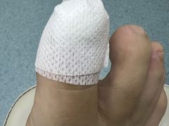 -新甲连锁灰指甲·甲沟炎·鸡眼(黑龙江路店)