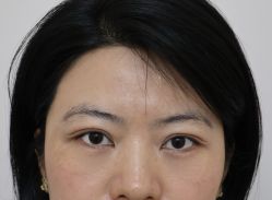 -天津健丽·去眼袋医疗美容机构