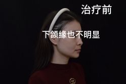-至简医疗美容·医生集团