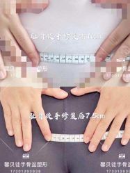 -梦斯绮私密催乳修复中心