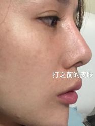 -Yestar宁波艺星整形医院