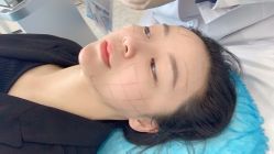-杭州星婉馨悦医疗美容