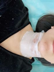 体验后-苏州卫康美容医院