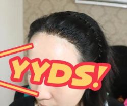 -大麦微针植发丨全国连锁