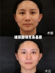 -上海漾颜医疗美容