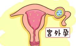 -邢台妇产医院