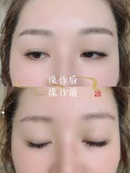 -西施无菌半永久纹绣眉眼影唇轻增发纹发际线