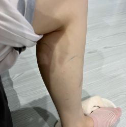 -agge蛋白医美