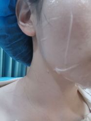 体验后-南京康美美容医院·旗舰店