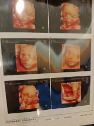 -杭州贝瑞斯美华妇儿医院·早孕·产检·儿科