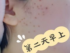 -大连市皮肤病医院