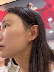 -长沙雅美医疗美容医院