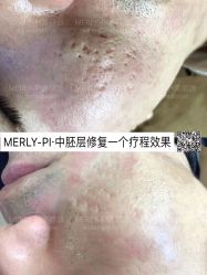 -MLP美丽派·问题肌疗愈中心