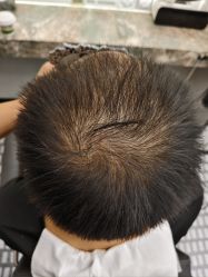 -唐风采假发补发定制