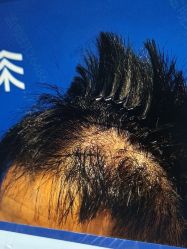 -雍禾植发全国连锁