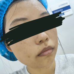 体验后-郑荃丽格医疗美容