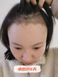 -雍禾植发全国连锁