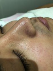 -苑苑vbeauty科技美容SPA