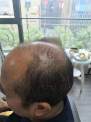 -唐风采假发补发定制