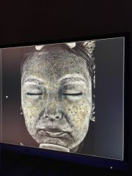 -圣嘉新医疗美容医院