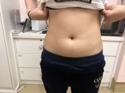 -广州美莱医疗美容医院