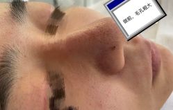 体验前-深圳医恒美医疗美容