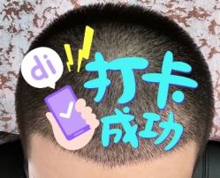 -大麦微针植发全国连锁