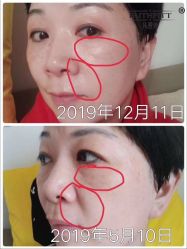 -凡碧诗毛孔收细