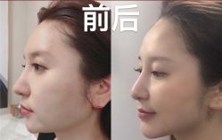 -和颜一美轻医美连锁
