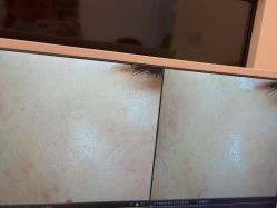 -苑苑vbeauty科技美容SPA
