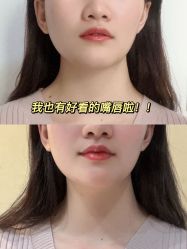 -Yestar艺星医疗美容医院