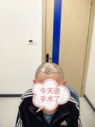 -大麦微针植发全国连锁