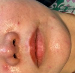 -比华利美容医院