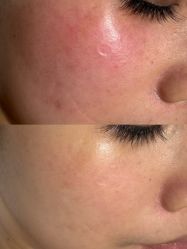 点击看大图 -MLP美丽派·问题肌疗愈中心