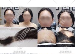 -发饰美男士增发补发假发定制店