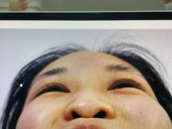 体验前-西安壹加壹医疗美容·西北抗衰旗舰店