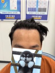 -大麦微针植发全国连锁