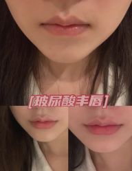 -上海漾颜医疗美容