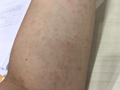 -龙达温泉生态城