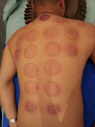 -悦艾堂·中医拔罐减肥·美体艾灸连锁