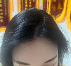 -大麦微针植发丨全国连锁