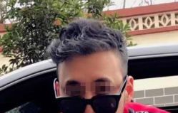 -大麦微针植发全国连锁