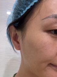 -安徽合肥韩美整形外科医院