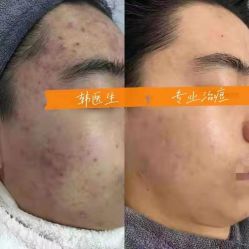 -瓷肌博士·祛痘科技美肤