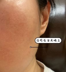 体验后-上海玫瑰医疗美容医院
