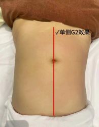 -Lily纤美·科技减脂中心