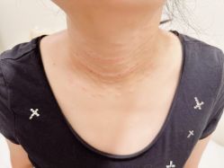 -海涛医疗美容·面部抗衰·注射美鼻