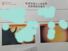 -杭州市第三人民医院
