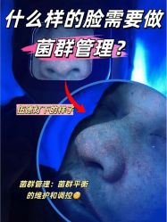-MLP美丽派·问题肌疗愈中心