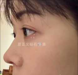 -北京米扬丽格医疗美容·联合丽格鼻整形中心